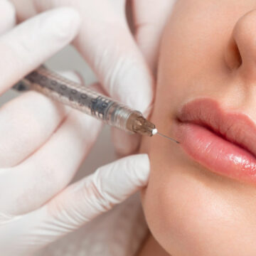 Dermal Fillers