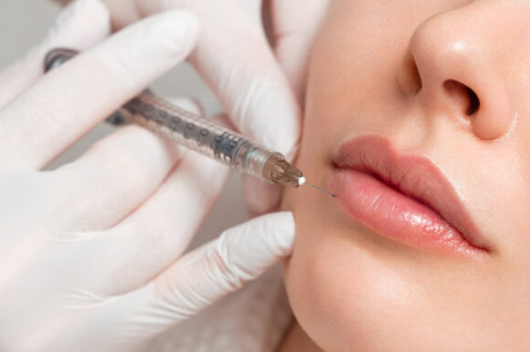 dermal-fillers-cover Dermal Fillers